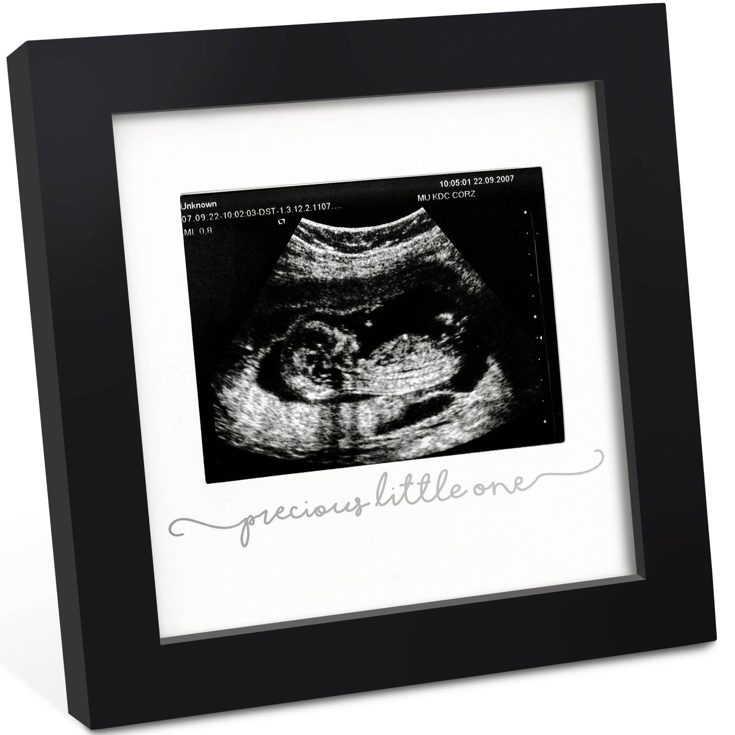 KeaBabies Solo Baby Sonogram Picture Frame: Onyx Black