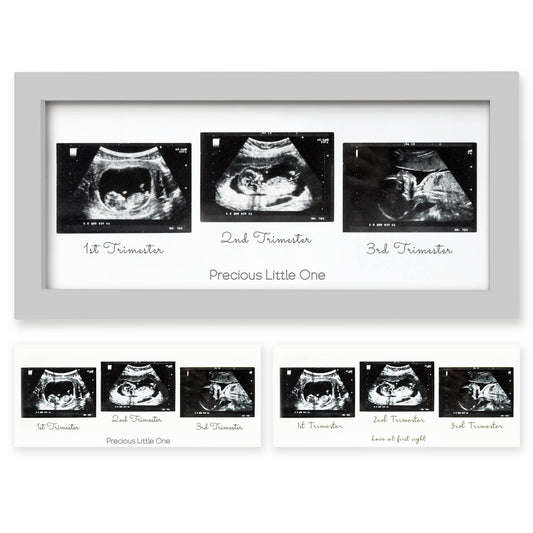 KeaBabies Trio Sonogram Frame (Cloud Gray)
