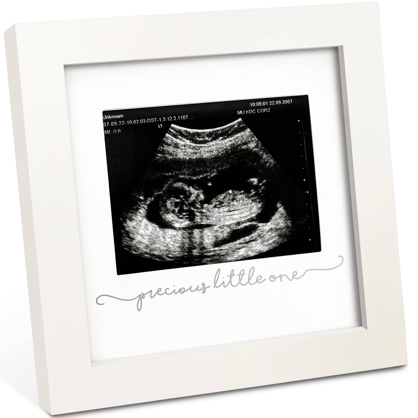KeaBabies Solo Baby Sonogram Picture Frame: Alpine White