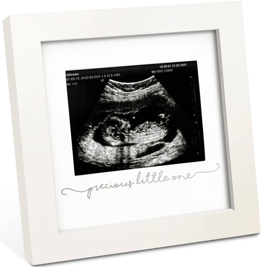 KeaBabies Solo Baby Sonogram Picture Frame: Alpine White
