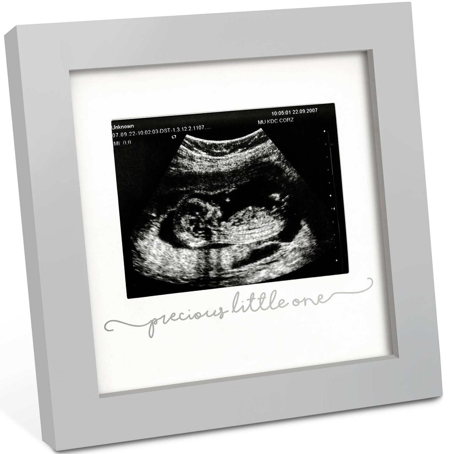 KeaBabies Solo Baby Sonogram Picture Frame: Cloud Gray