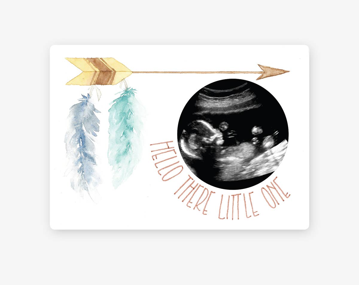 Magnetic Feather Baby Ultrasound Wooden Photo Frame