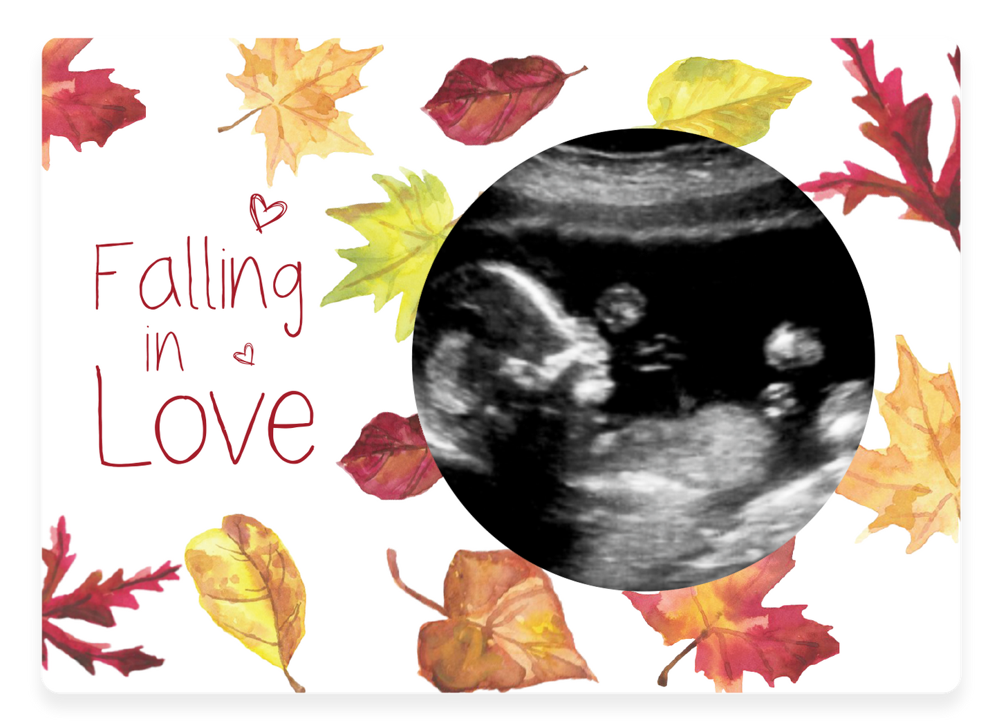 Magnetic Falling in Love Ultrasound Wooden Photo Frame